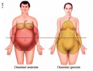 Ejemplos de obesidad androide y genoide