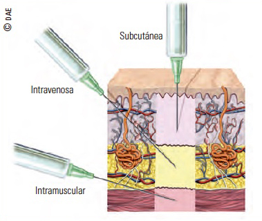 administración de medicamentos vía intramuscular